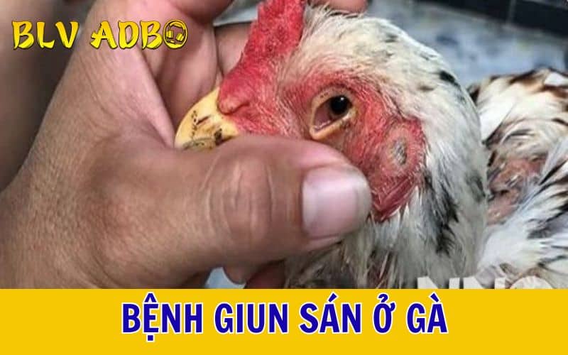 Bệnh giun sán Bệnh giun sán